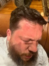 Współpracownik Nawalnego zaatakowany przed swoim domem. Trafił do szpitala
