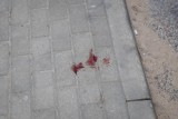 Atak nożownika w powiecie żnińskim. Mężczyzna został raniony w szyję. Trwają poszukiwania 