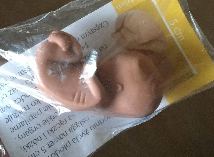 Płód w 3D na rekolekcjach w Szczecinie. Psycholog: Straszą dzieci
