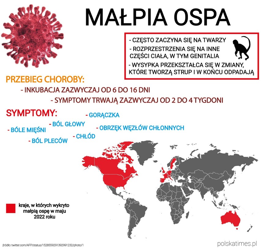 Małpia ospa w Europie i na świecie. Gdzie przybywa zakażeń?