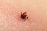 Czy koronawirusa mogą przenosić komary, kleszcze i inne pasożyty żerujące na krwi? 