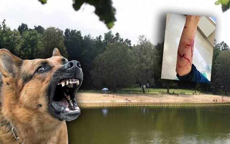 Wyrok w sprawie małżeństwa, którego trzy psy dotkliwie pogryzły biegacza w Lesie Łagiewnickim, zapadł w Sądzie Okręgowym w Łodzi