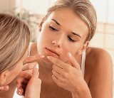 Jak pielęgnować cerę z trądzikiem różowatym? - radzi dermatolog