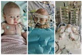 9-miesięczną Gaję ze Straszyna czeka druga operacja serca. Potrzebna pomoc!