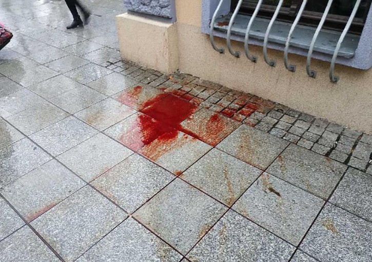 Bójka w centrum Łodzi. Napastnik ugodził mężczyznę nożem w twarz! 