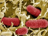 Bakteria E-coli jest blisko? Dzieci wróciły z Niemiec i się źle poczuły