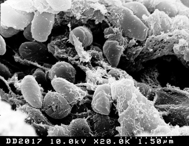 Bakterie dżumy – widok pod mikroskopem elektronowym