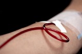 Alergia po transfuzji krwi? To może być skutek diety dawcy. Przetaczanie krwi może być znaczniej bezpieczniejsze dla pacjentów