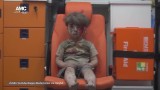 5-letnie dziecko z Aleppo w Syrii uratowane. To Omran WSTRZĄSAJĄCE ZDJĘCIA 