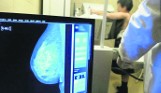 Breast Cancer Unit. Nowoczesne leczenie raka piersi w łódzkim „Koperniku”
