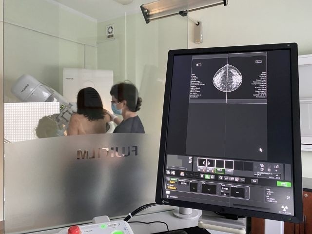 Nowy mammograf w pracowni WOMP w Szczecinie. Panie mogą korzystać z bezpłatnych badań