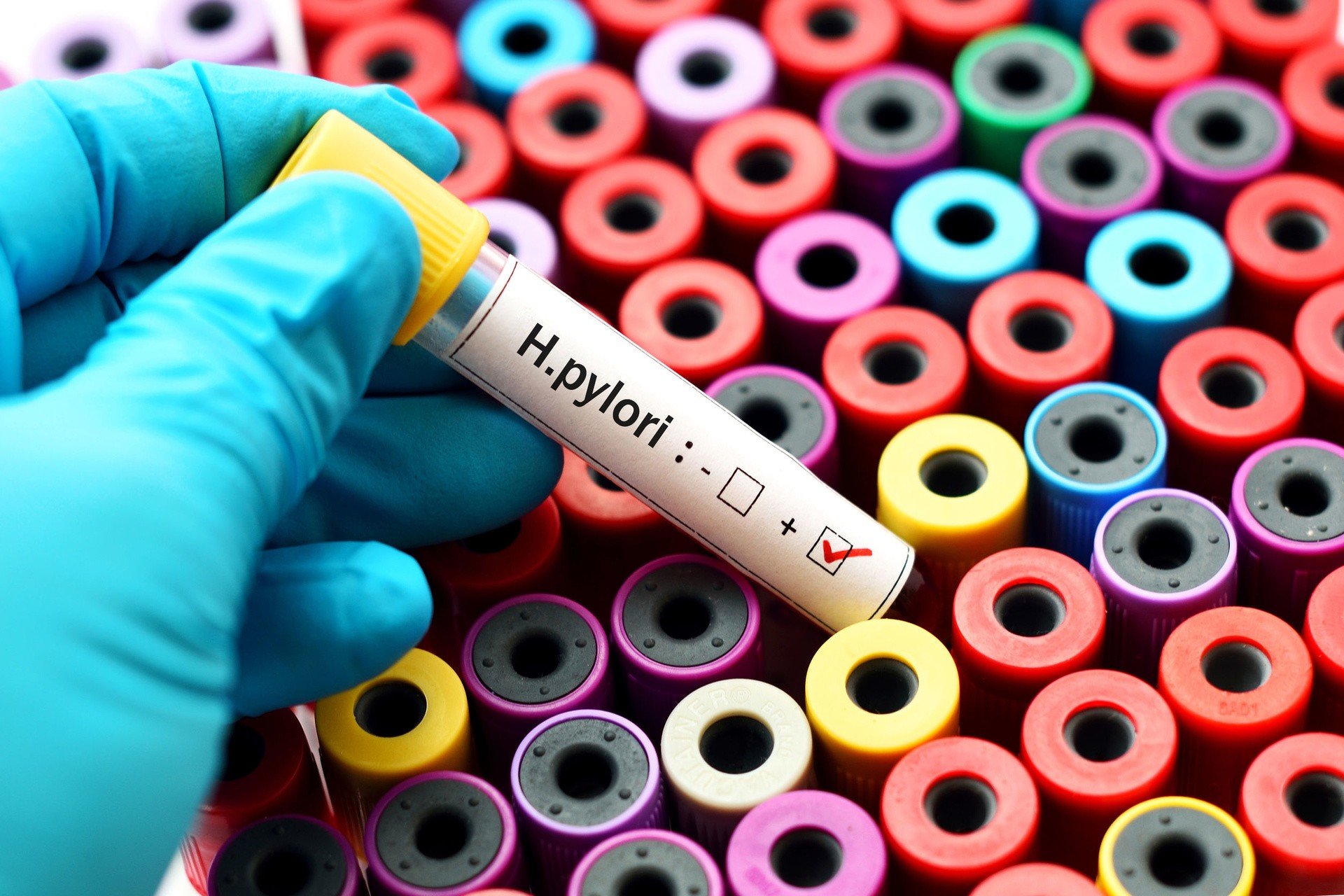 Byblomst Meddele Skov Helicobacter pylori – jak się można zarazić, jakie testy wykonać i czym  leczyć objawy | Strona Zdrowia