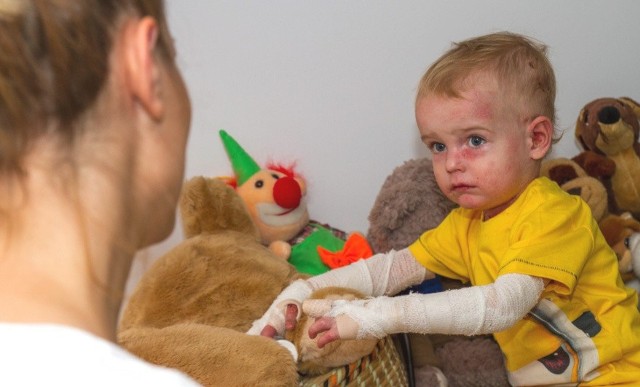 Miesięczny koszt pielęgnacji chorego na EB od 1 lipca będzie rzędu 8 tys. zł