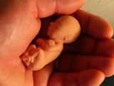 W Chinach dokonuje się 13 milionów aborcji rocznie