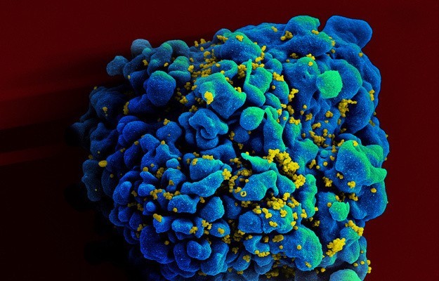 Po raz drugi w historii medycyny udało się powstrzymać rozwój wirusa HIV u zarażonego pacjenta.