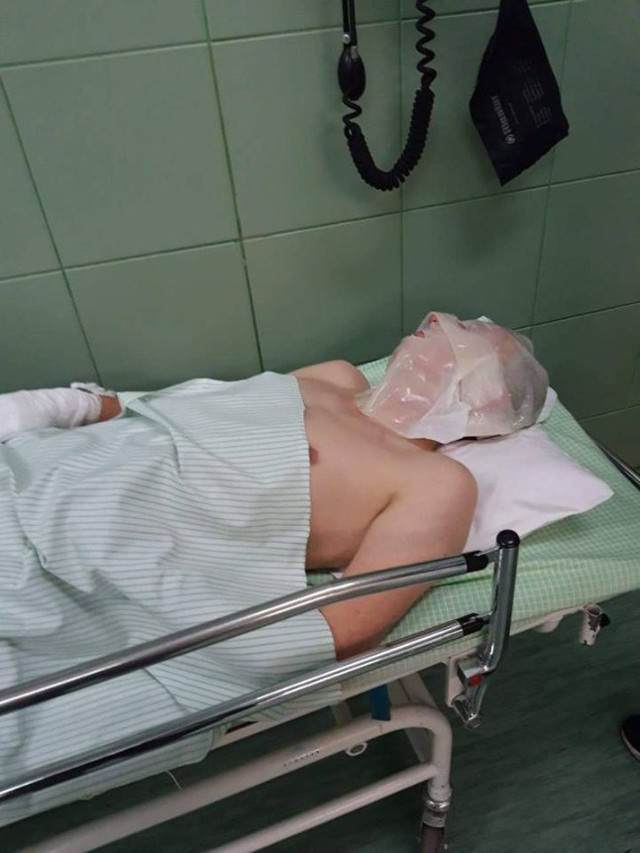 W wyniku wybuchu gazu w bloku w Gierałcicach ciężko poparzony został 23-letni Mariusz.
