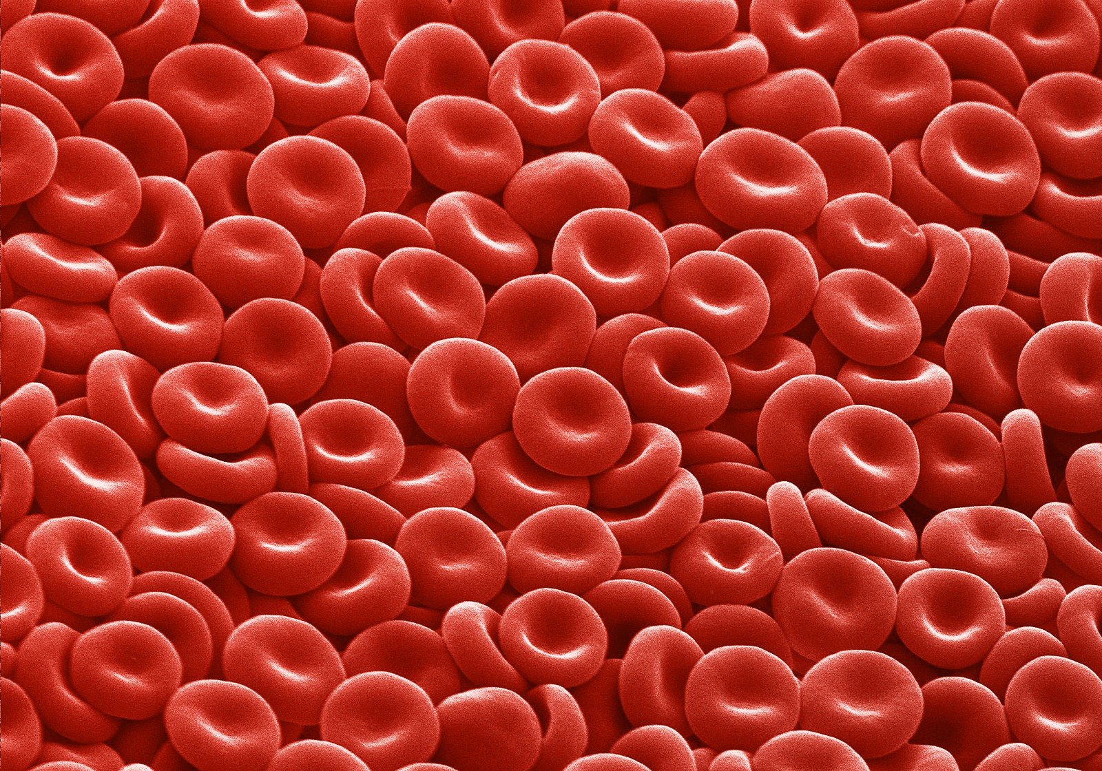 Erytrocyty Swieze W Moczu 1 3 Erytrocyty w moczu i we krwi. Badania, wyniki i normy dla zawartości krwinek czerwonych | Strona