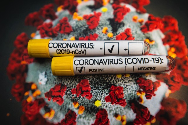 Przypadki wariantów Beta, Gamma i Delta pojawiły się już na Opolszczyźnie. Nowe szczepy koronawirusa zostały potwierdzone w trakcie badań wykonanych  po powrocie do kraju.