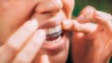 Paski wybielające zęby to alternatywa dla zabiegu u denstysty. Jak działają i jakie dają efekty? Poznaj wady i zalety tej metody