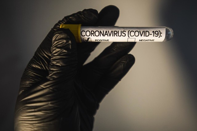 10 nowych przypadków zakażenia koronawirusem w regionie.