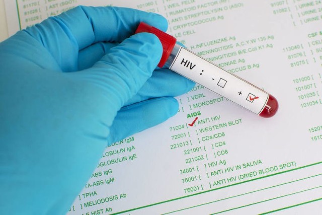 Gdzie w Toruniu można zrobić test na HIV i AIDS?