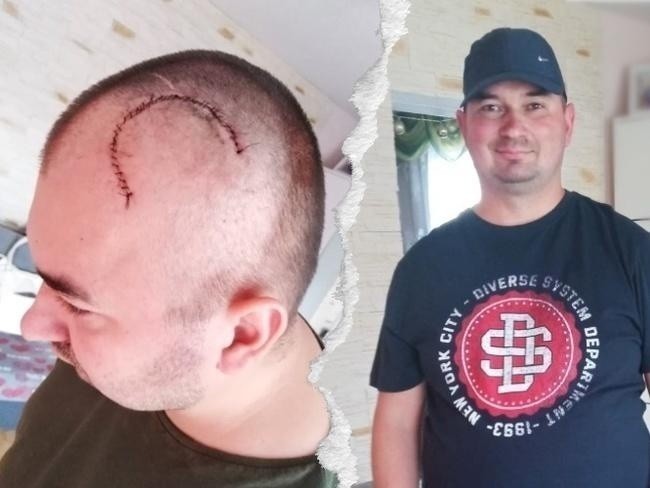 36 - letni Marcin Gula zachorował na złośliwego guza mózgu!...