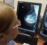 Darmowe badania mammograficzne dla pań