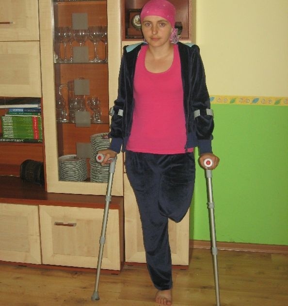 Pani Joanna potrzebuje pomocy. Fundacja Miśka Zdziśka zbiera pieniądze na zakup protezy dla niej.