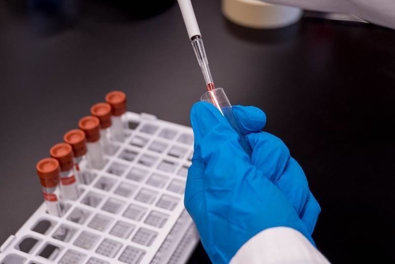 Liczba wykonanych testów na koronawirusa na Pomorzu dogoniła już poziom krajowy 