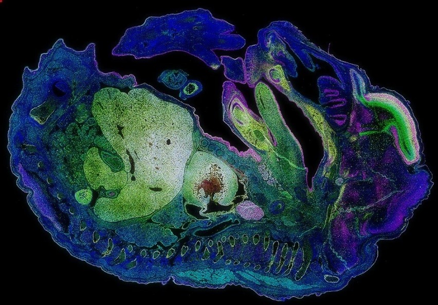 Zarodek widziany w nowym mikroskopie.