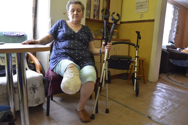6 marca w Krakowie pani Jadwidze amputowano prawą nogę, którą przez blisko cztery lata leczyła pod okiem gorlickich lekarzy