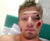 Alex Koliadych, sportowiec z Gorzowa potrącony na pasach w Inowrocławiu. Jechał na zgrupowanie przed ME. Życie uratowała mu walizka