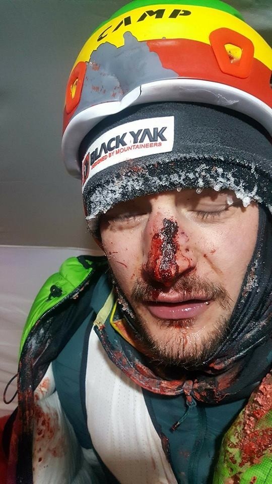 Wypadek Adama Bieleckiego na K2: Na alpinistę spadł głaz. Adam Bielecki ma złamany nos. Czy zdobędzie szczyt K2?