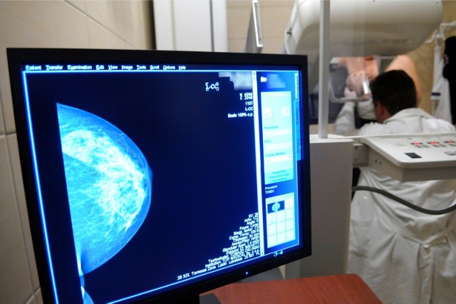 Mammografia uznawana jest za najlepszą metodę wykrywania raka piersi we wczesnym stadium.
