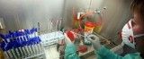 Pacjenci ze szpitala płucnego w Rzeszowie badani są pod kątem groźnej bakterii New Delhi