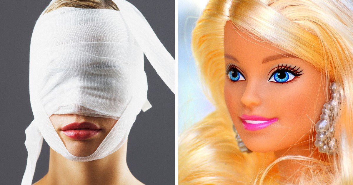 Żywe Barbie, mężczyźni jak Ken. Ile pieniędzy wydali na operacje  plastyczne? Tak wyglądają ludzkie lalki | Portal i.pl