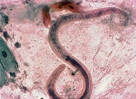 Węgorek jelitowy (Strongyloides stercoralis) niewielki, ponad 2 mm nicień, jest jednym z nielicznych pasożytów, które mogą żyć samodzielnie poza atakowanym organizmem. Głównie w glebie. Larwy mogą wniknąć do ludzkiego organizmu przez odkrytą skórę. Wywołuje chorobę zwaną węgorzycą. Zarażenie człowieka następuje przez zetknięcie skóry z larwami pasożyta. Węgorek (samica) pasożytuje w błonie śluzowej dwunastnicy i jelita czczego, rzadziej w tkance płucnej. Zaatakowany organizm wydala na zewnątrz larwy, które mogą inwazyjnie atakować kolejne osoby. Zarażanie żywiciela może utrzymywać się przez dziesiątki lat. Objawy węgorka jelitowego: bóle brzucha, biegunka, świąd odbytu, zmiany skórne, uczucie osłabienia, pobudzenie, kaszel, duszności. Masywne inwazje powodują zmiany w postaci wrzodziejącego, a niekiedy krwotocznego nieżytu dwunastnicy i jelita czczego.