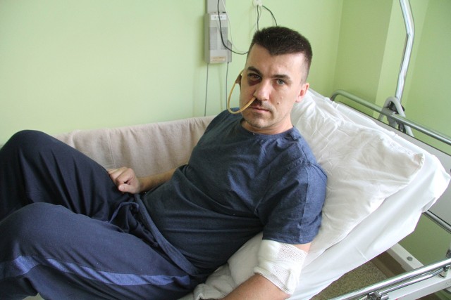 Rafał Machowski przebywa w szpitalu, gdzie przeszedł rekonstrukcję kości twarzy pogruchotanych butelką z piwem