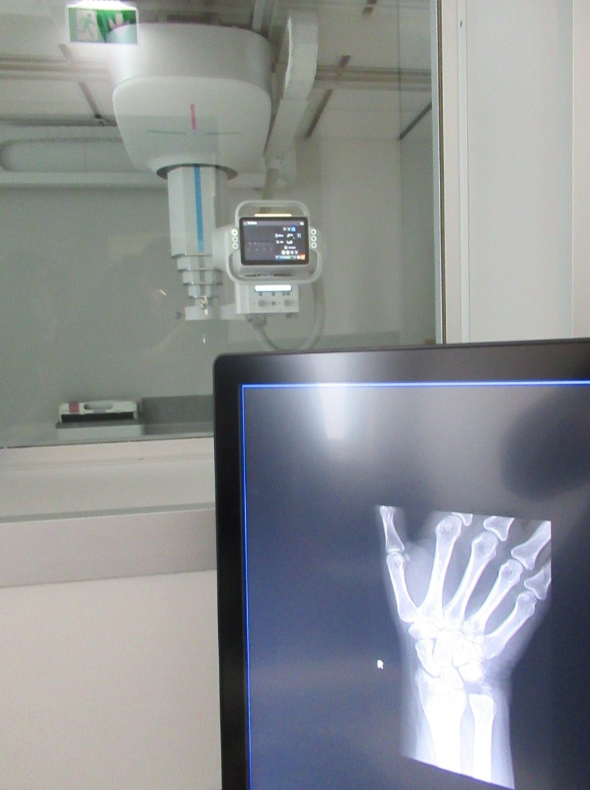 Supernowoczesny aparat RTG wykorzystujący sztuczną inteligencję już działa w Szpitalu Miejskim nr 4 w Gliwicach