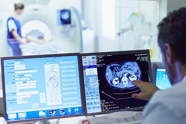 Niedokrwienny udar mózgu to poważny problem zdrowotny, w samym 2022 roku zarejestrowano w Polsce 73 900 przypadków wylewów.