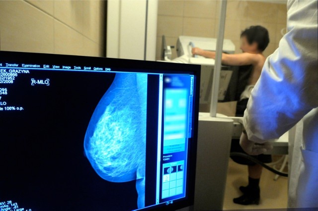 - Przestrzenne badanie piersi sprawi, że skuteczność wykrywania raka będzie większa - mówi lek. Filipowska.