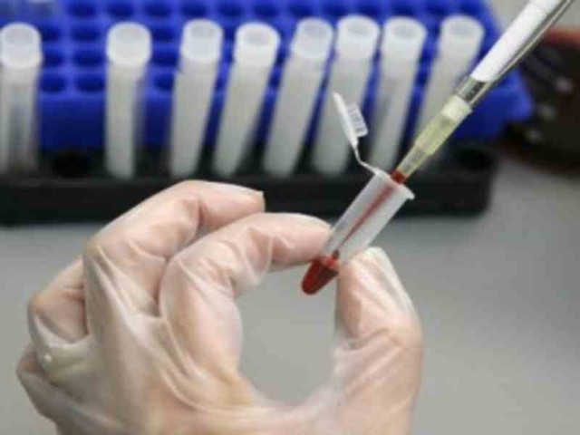 W Koszalinie chora kobieta chciała zrobić badania na obecność wirusa świńskiej grypy.