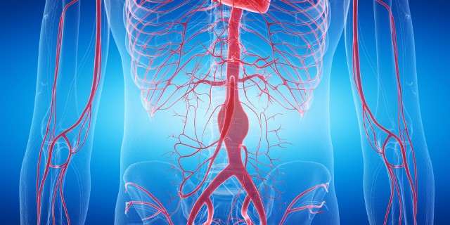 Tętniaki aorty brzusznej (AAA) to poszerzenie części tętnicy głównej zlokalizowanej poniżej przepony i rozgałęziającej się na tętnice udowe