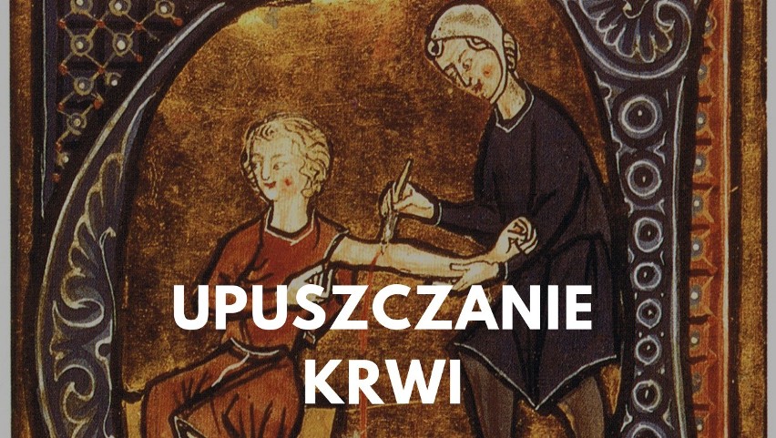 Upuszczanie krwi (flebotomia) było popularnym zabiegiem...