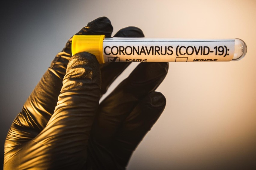 Koronawirus w Polsce: aktualne dane z 26.01.2021
