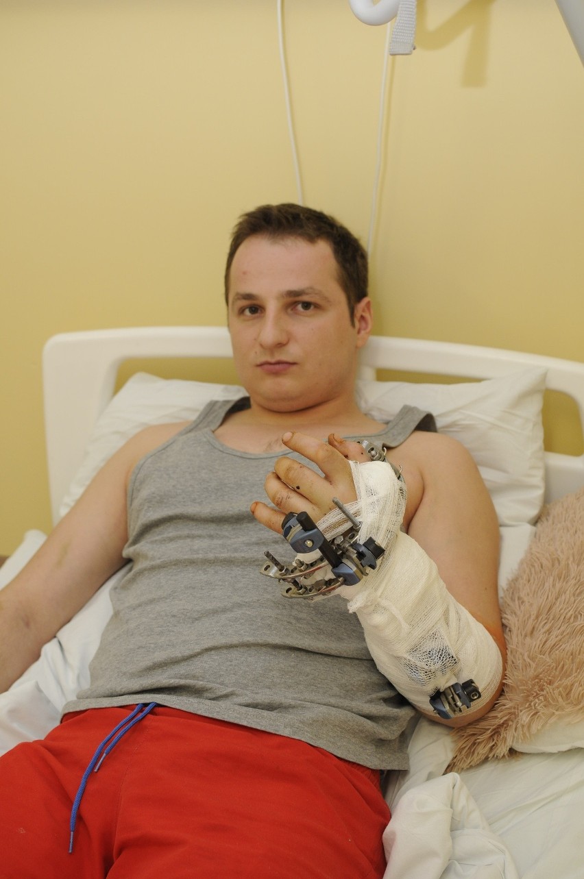 Sukces lekarzy z Łęcznej. Uratowali 24-latkowi oderwaną dłoń 