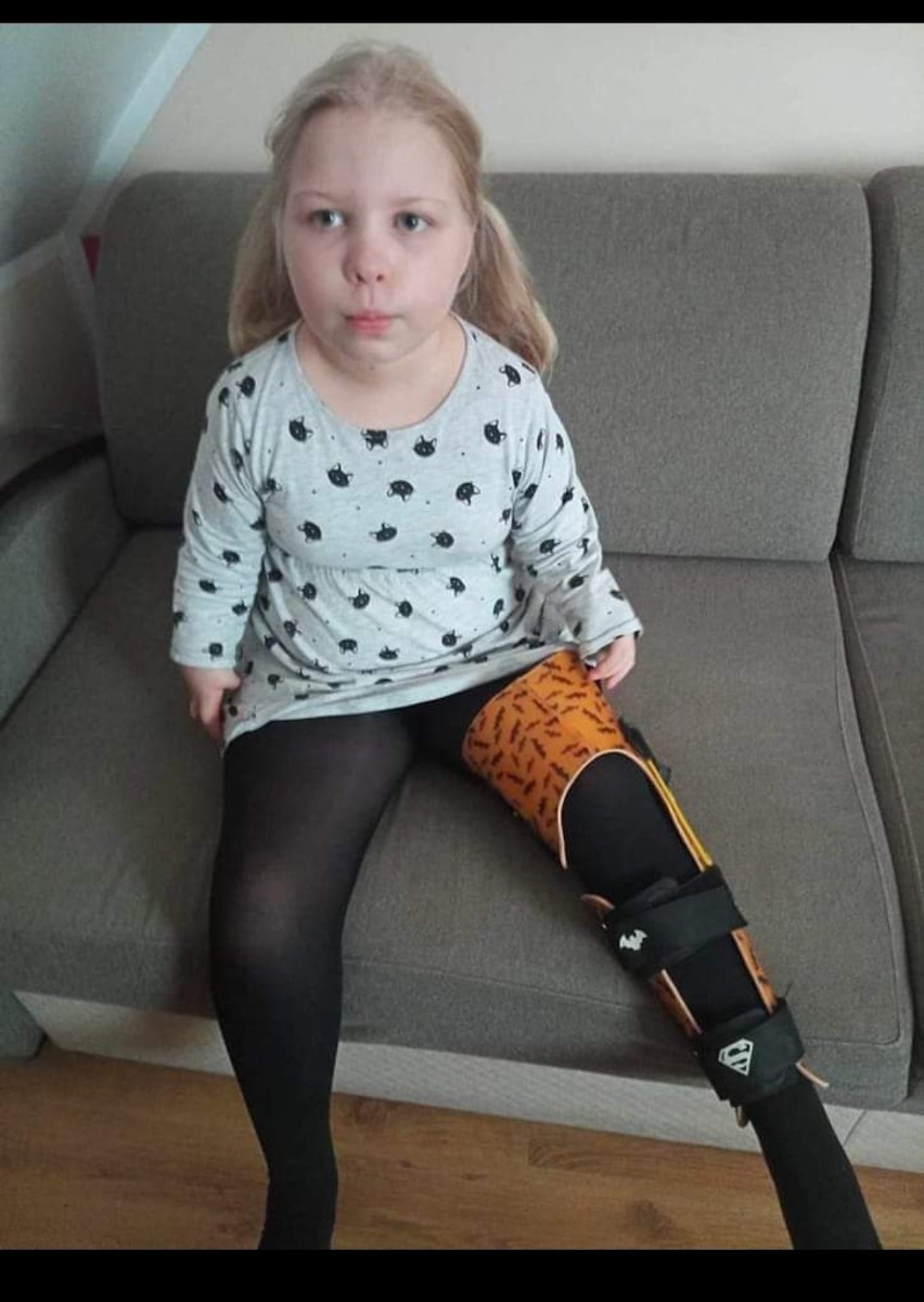 9-latka pilnie potrzebuje operacji ortopedycznych nóg