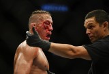 Niko "The Hybrid" Price pokazał zmasakrowaną twarz po walce na gali UFC 249. Przerażający widok! [ZDJĘCIA]