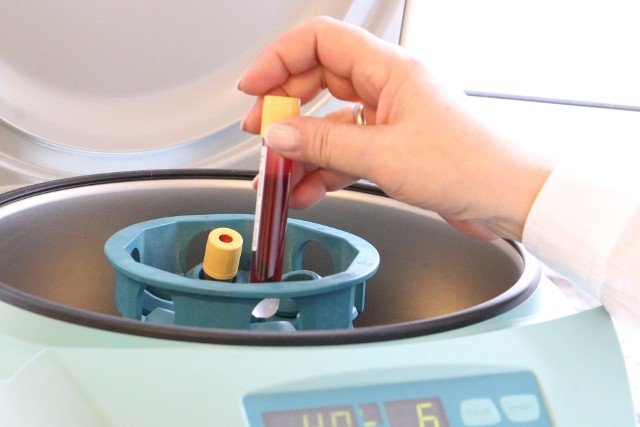 Oznaczanie płytek krwi (PLT) jest integralną częścią badania morfologii krwi