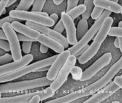 Bakterie E.coli i żelazo w wodzie w Lędzinach